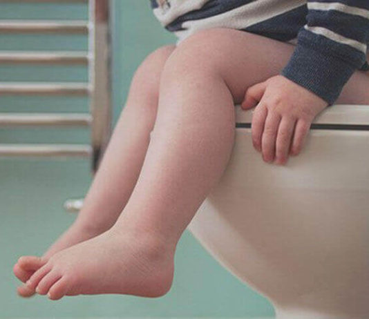 Анатомический запор