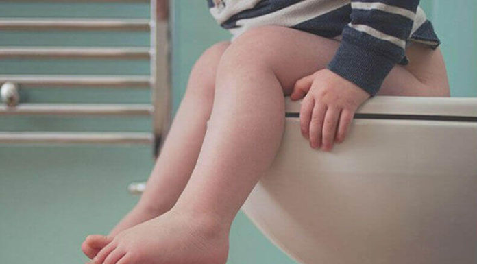 Анатомический запор