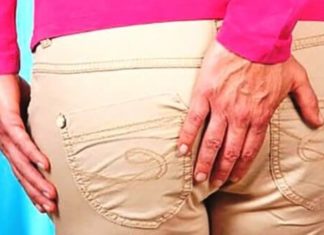 Стадии геморроя и их лечение