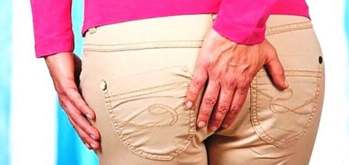 Стадии геморроя и их лечение