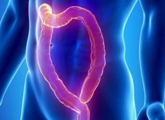 Психогенный запор