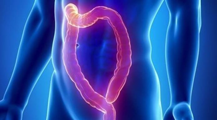 Психогенный запор