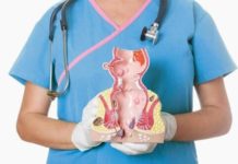 Основные признаки геморроя