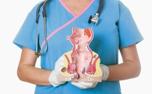 Основные признаки геморроя